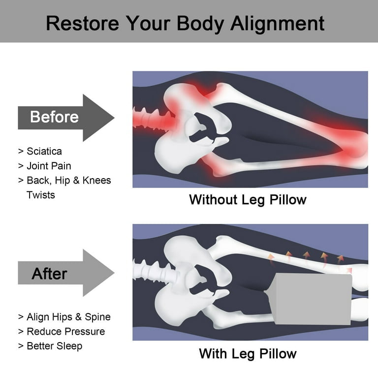 Diagram showing body alignment before and after using a leg pillow with text about pain relief.